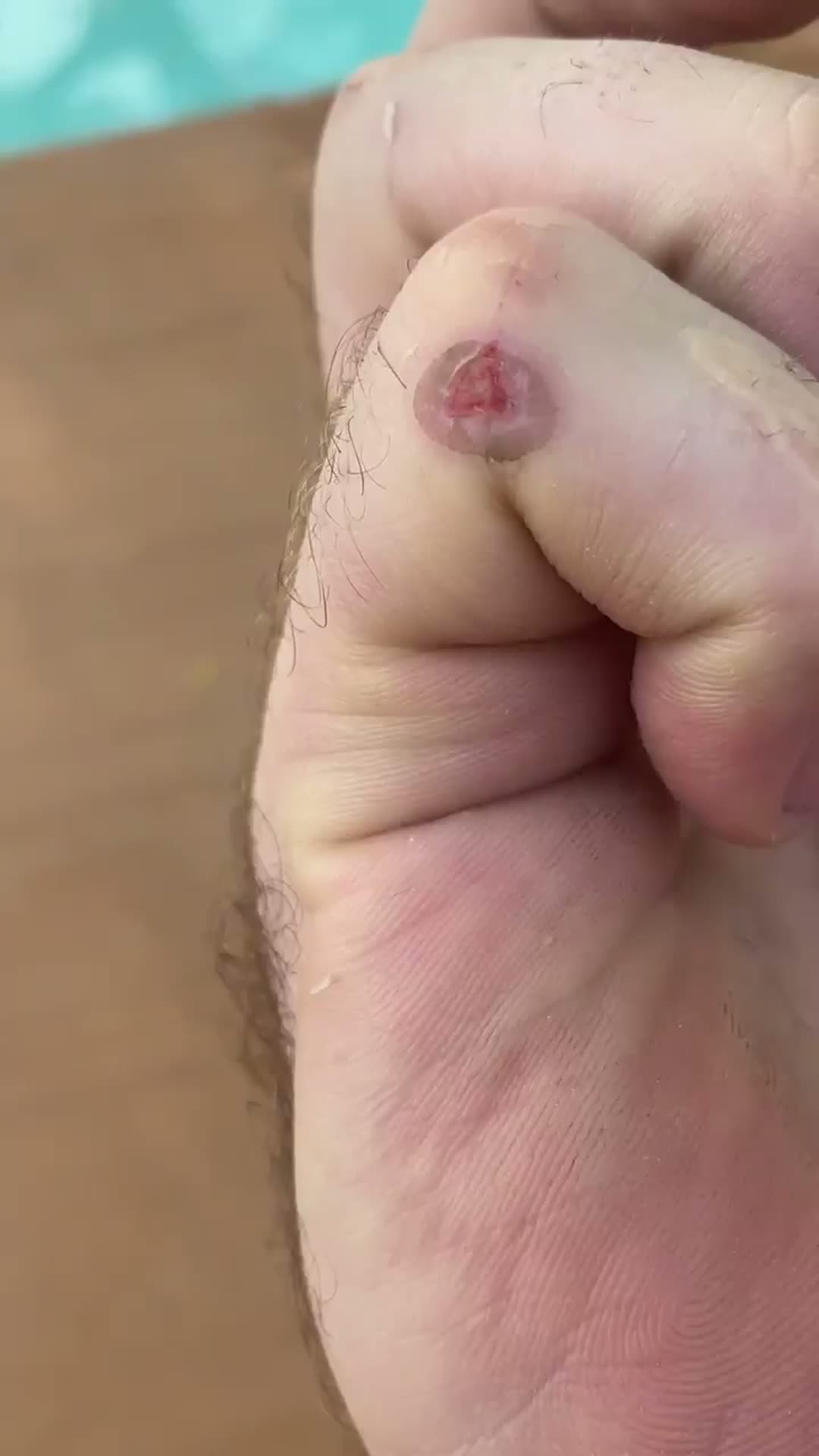 Tom's hand after a ProCharger install. Wedding ring, cuts, dirt under the nails.